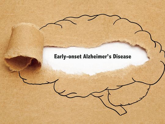 What is early-onset Alzheimers?