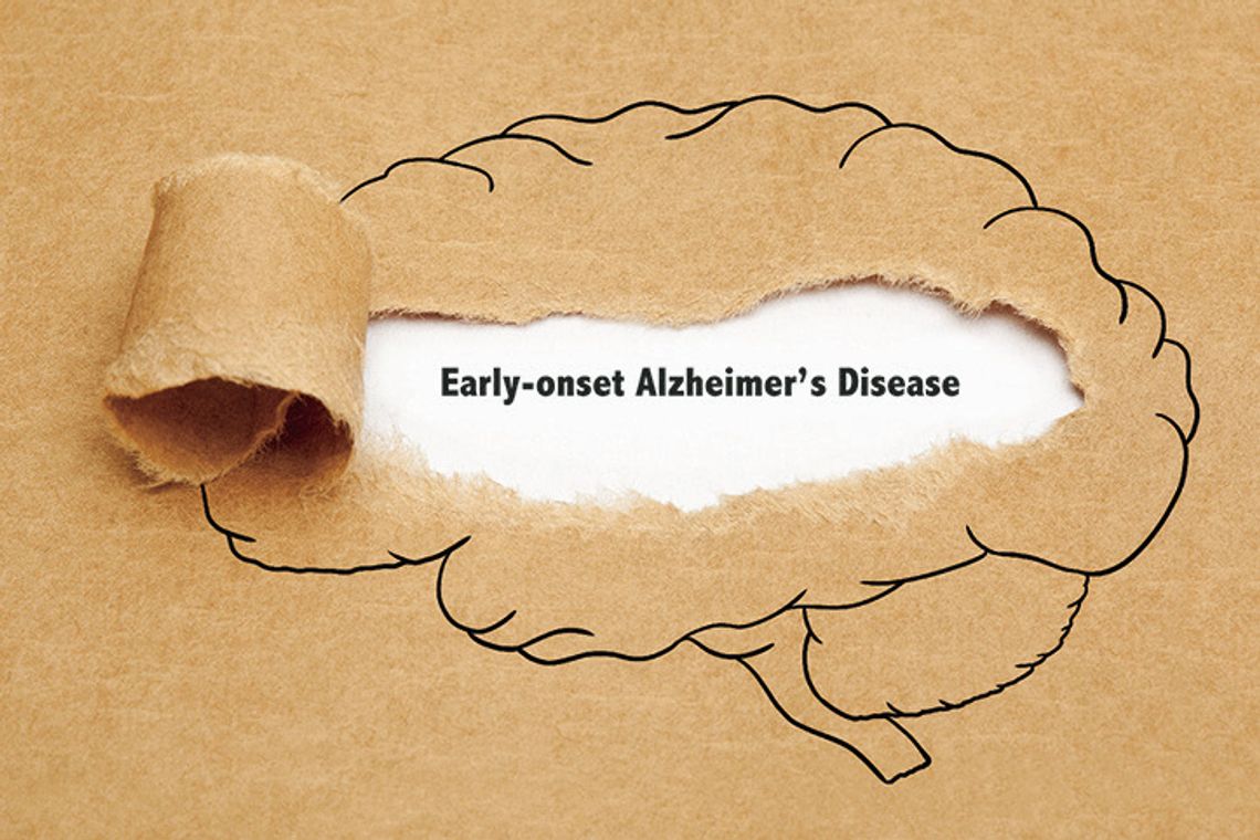 What is early-onset Alzheimers?